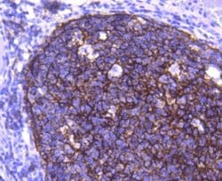 CD21 Antibody (SC0681), Novus Biologicals 100&mu;L:Antibodies, Monoclonal