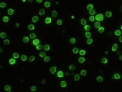 CD229/SLAMF3/Lymphocyte Antigen 9 Rabbit anti-Mouse, Clone: 2, Novus Biologicals