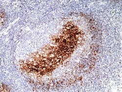 CD23/Fc epsilon RII Antibody (RM406), Novus Biologicals 100 &mu;L; Unconjugated:Antibodies,