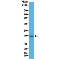 CD23/Fc epsilon RII Antibody (RM406), Novus Biologicals 100 &mu;L; Unconjugated:Antibodies,