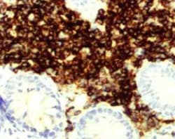 CD23/Fc epsilon RII Antibody (EBVCS2), Novus Biologicals:Antibodies:Primary