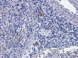 CD25/IL-2R alpha Antibody (Basiliximab) - Chimeric - Azide and BSA Free,