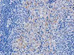CD25/IL-2R alpha Antibody (Daclizumab) - Azide and BSA Free, Novus Biologicals 0.025 mg | Buy Online | Novus Biologicals | Fisher Scientific