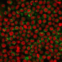 CD27/TNFRSF7 Antibody (LPFS2/1611), Novus Biologicals:Antibodies:Primary