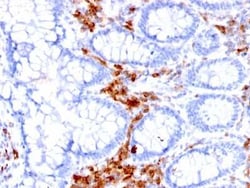 CD27/TNFRSF7 Antibody (LPFS2/1611), Novus Biologicals:Antibodies:Primary