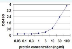 PD-L1 Antibody Pair, Novus Biologicals 1 Set | Buy Online | Novus Biologicals | Fisher Scientific
