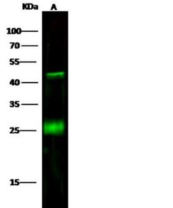 CD3 delta Rabbit anti-Human, Clone: 6, Novus Biologicals 50 &mu;g; Unconjugated:Antibodies,