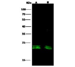 CD3 delta Antibody, Novus Biologicals:Antibodies:Primary Antibodies