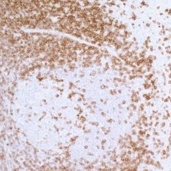 CD3 epsilon Antibody (BL-298-5D12), Novus Biologicals 100 &mu;L | Buy Online | Novus Biologicals | Fisher Scientific