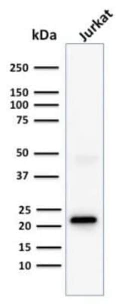 CD3 epsilon Antibody (C3e/1308), Novus Biologicals 100&mu;g; Unlabeled:Antibodies,