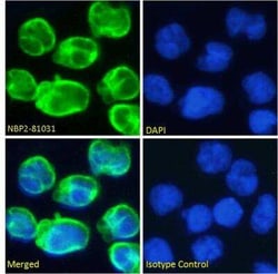 CD3 epsilon, Rabbit anti-Human, Clone: OKT-3 (muromonab), Novus Biologicals:Anticuerpos:Anticuerpos