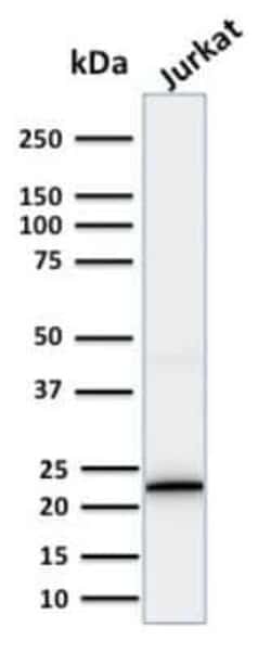 CD3 epsilon Antibody (PC3/188A), Novus Biologicals 20&mu;g; Unlabeled:Antibodies,