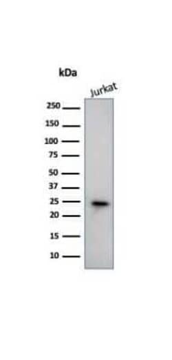 CD3 epsilon Antibody (PC3/188A), Novus Biologicals 20&mu;g; Unlabeled:Antibodies,