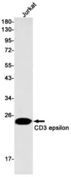 CD3 epsilon Antibody (S02-1B5), Novus Biologicals 100 &mu;g; Unconjugated:Antibodies,