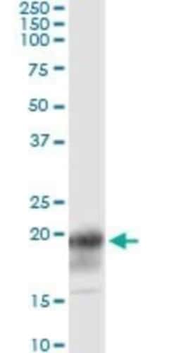 CD3 zeta Antibody (4A12-F6), Novus Biologicals 0.1 mg | Buy Online | Novus Biologicals | Fisher Scientific
