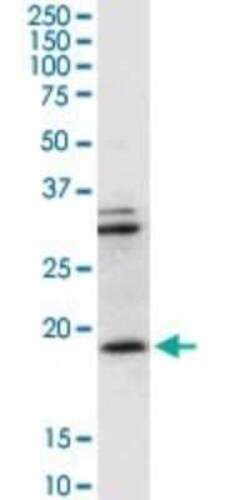CD3 zeta Antibody, Novus Biologicals 0.1 mg | Buy Online | Novus Biologicals | Fisher Scientific