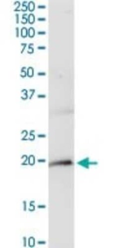 CD3 zeta Antibody, Novus Biologicals 0.1 mg | Buy Online | Novus Biologicals | Fisher Scientific