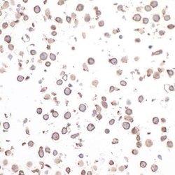CD30/TNFRSF8 Antibody (BLR055F), Novus Biologicals 100 &mu;L; Unconjugated:Antibodies,