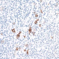 CD30/TNFRSF8 Antibody (BLR055F), Novus Biologicals 100 &mu;L; Unconjugated:Antibodies,