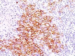 CD30/TNFRSF8 Antibody (CD30/412), Novus Biologicals 0.1mg; Unlabeled:Antibodies,