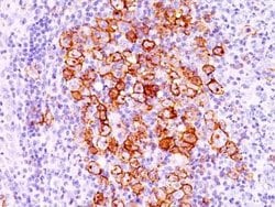 CD30/TNFRSF8 Antibody (CD30/412), Novus Biologicals 0.1mg; Unlabeled:Antibodies,