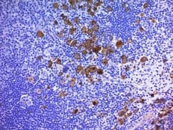 CD30/TNFRSF8 Antibody (Ber-H2 + CD30/412), Novus Biologicals:Antibodies:Primary