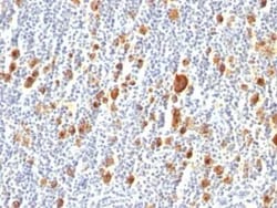 CD30/TNFRSF8 Antibody (Ber-H2), Novus Biologicals:Antibodies:Primary Antibodies