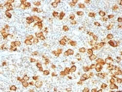CD30/TNFRSF8 Antibody (Ki-1/1505R), Novus Biologicals:Antibodies:Primary