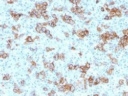 CD30/TNFRSF8 Antibody (Ki-1/779), Novus Biologicals:Antibodies:Primary