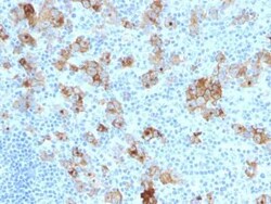 CD30/TNFRSF8 Antibody (SPM121), Novus Biologicals 0.1mL; Unlabeled:Antibodies,