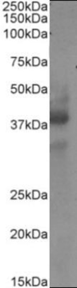 CD34 Antibody (My10) - Chimeric - Azide and BSA Free, Novus Biologicals