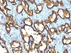 CD34 Antibody (QBEnd/10 + HPCA1/763), Novus Biologicals:Antibodies:Primary