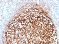 CD35 Antibody (CR1/4382R) - Azide and BSA Free, Novus Biologicals 100 &mu;g | Buy Online | Novus Biologicals | Fisher Scientific