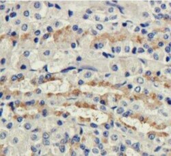 CD35, Rat anti-Mouse, Clone: 8C12, Novus Biologicals 0.2 mg | Buy Online | Novus Biologicals | Fisher Scientific