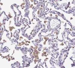 CD35 Antibody, Novus Biologicals:Anticuerpos:Anticuerpos primarios