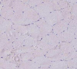 CD35 Antibody, Novus Biologicals:Anticuerpos:Anticuerpos primarios