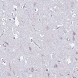 CD35 Antibody, Novus Biologicals 25 &mu;L | Buy Online | Novus Biologicals | Fisher Scientific