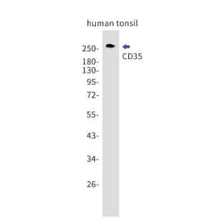 CD35 Antibody (S06-6D1), Novus Biologicals 100 &mu;g; Unconjugated:Antibodies,
