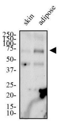 CD36 Antibody (1283D) - Azide and BSA Free, Novus Biologicals 0.1 mg; Unconjugated:Antibodies,