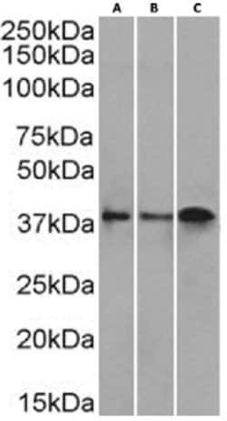 CD37 Rabbit anti-Human, Clone: IPO-24 (ZC37-24), Novus Biologicals 0.2