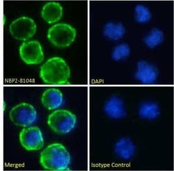 CD37, Rabbit anti-Human, Clone: WR17, Novus Biologicals 0.2 mg; Unconjugated:Antibodies,