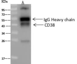 CD38 Rabbit anti-Human, Clone: 3, Novus Biologicals 100 &mu;g; Unconjugated:Antibodies,