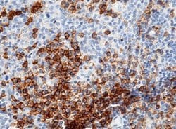 CD38 Rabbit anti-Human, Clone: 228, Novus Biologicals:Antibodies:Primary