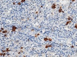 CD38 Rabbit anti-Human, Clone: 228, Novus Biologicals:Antibodies:Primary