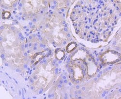 CD38 Rabbit anti-Human, Clone: SN07-20, Novus Biologicals 100 &mu;L | Buy Online | Novus Biologicals | Fisher Scientific