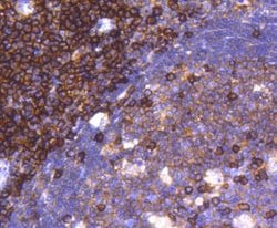 CD38 Rabbit anti-Human, Clone: SN07-20, Novus Biologicals 100 &mu;L | Buy Online | Novus Biologicals | Fisher Scientific