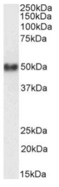 CD38, Rabbit anti-Human, Clone: AT13/5, Novus Biologicals 0.2 mg | Buy Online | Novus Biologicals | Fisher Scientific