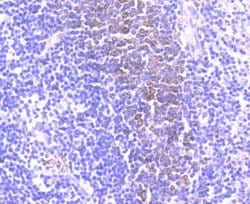 CD39/ENTPD1 Antibody (JA90-36), Novus Biologicals 100&mu;L:Antibodies,