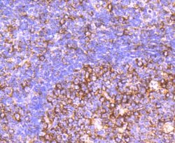 CD39/ENTPD1 Antibody (JA90-36), Novus Biologicals 100&mu;L:Antibodies,