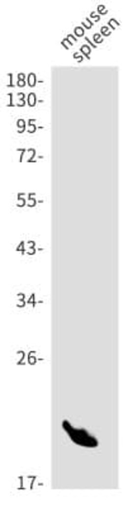 CD39/ENTPD1 Antibody (S09-3I2), Novus Biologicals 100 &mu;g | Buy Online | Novus Biologicals | Fisher Scientific